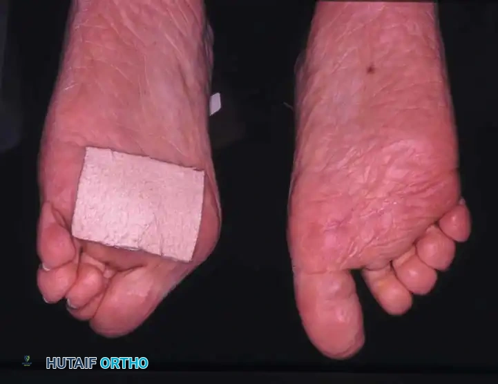 Hutaifortho's Orthopaedic Diagram