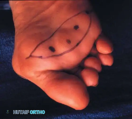 Hutaifortho's Orthopaedic Diagram