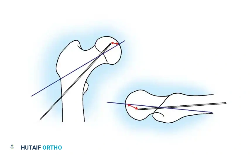 Hutaifortho's Orthopaedic Diagram
