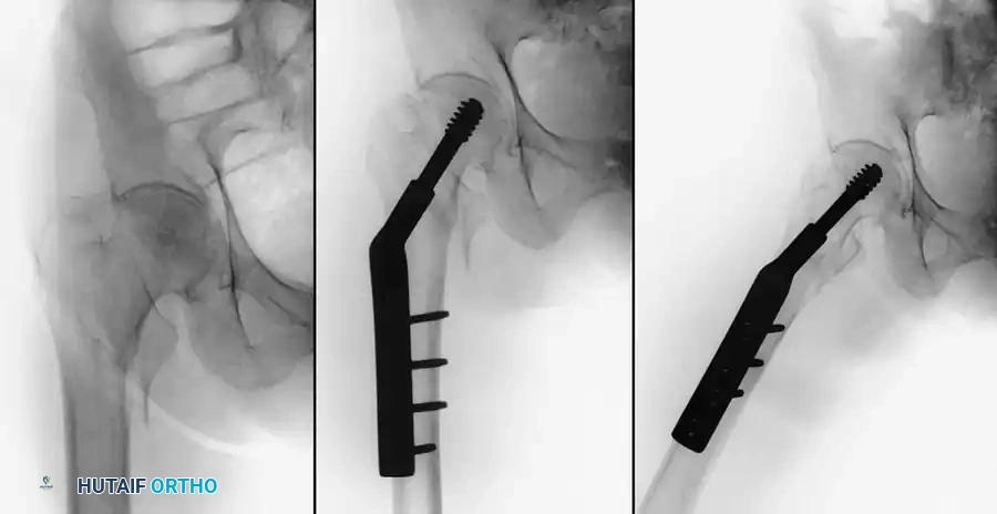 Hutaifortho's Orthopaedic Diagram