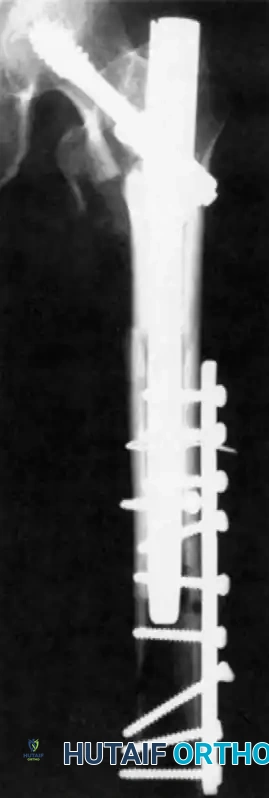 Hutaifortho's Orthopaedic Diagram