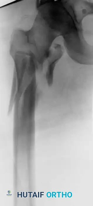 Hutaifortho's Orthopaedic Diagram