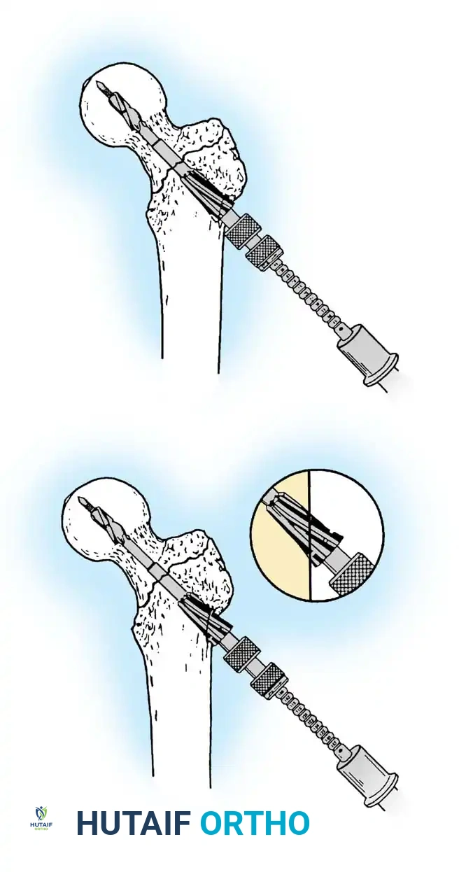 Hutaifortho's Orthopaedic Diagram