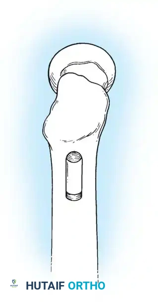 Hutaifortho's Orthopaedic Diagram