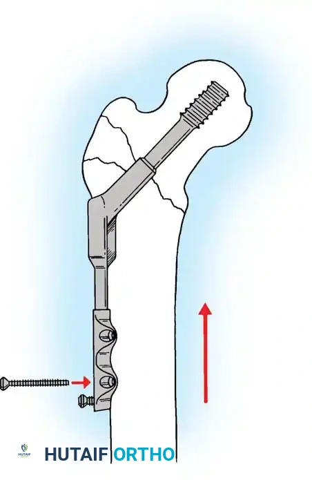 Hutaifortho's Orthopaedic Diagram
