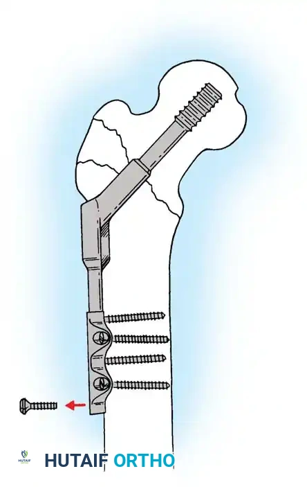 Hutaifortho's Orthopaedic Diagram
