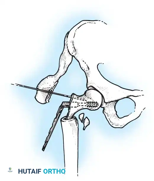 Hutaifortho's Orthopaedic Diagram