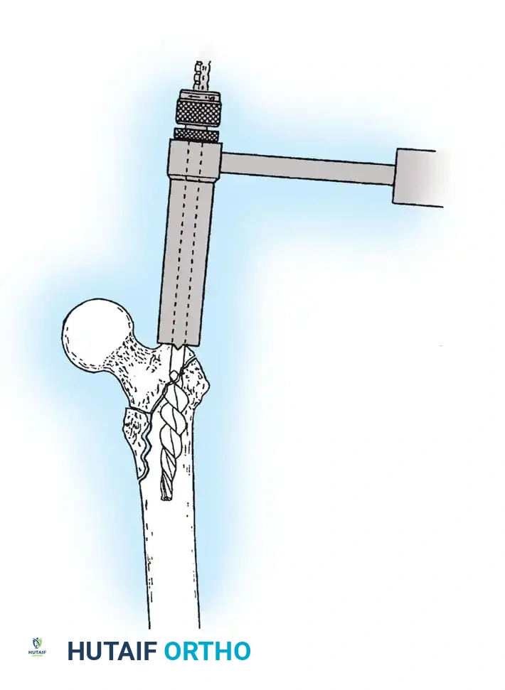 Hutaifortho's Orthopaedic Diagram