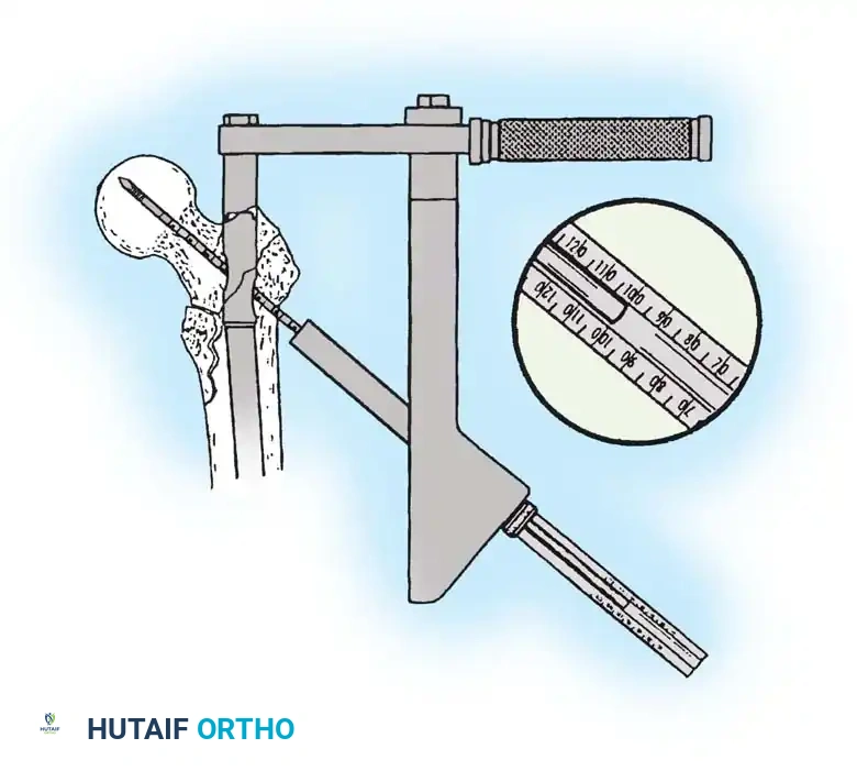 Hutaifortho's Orthopaedic Diagram