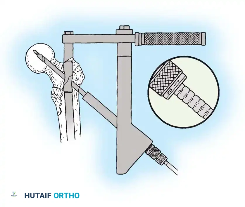 Hutaifortho's Orthopaedic Diagram