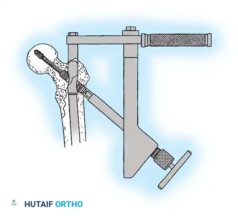 Hutaifortho's Orthopaedic Diagram
