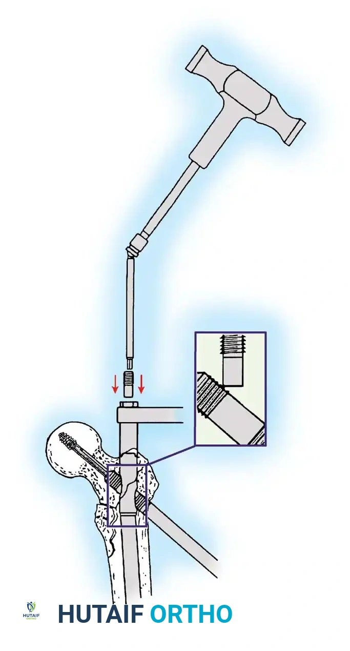 Hutaifortho's Orthopaedic Diagram