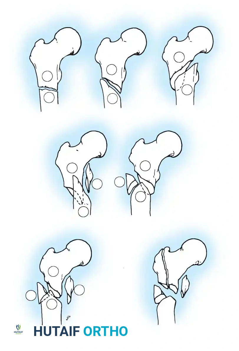 Hutaifortho's Orthopaedic Diagram