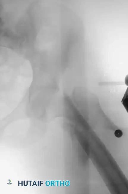 Hutaifortho's Orthopaedic Diagram