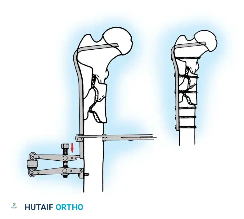 Hutaifortho's Orthopaedic Diagram