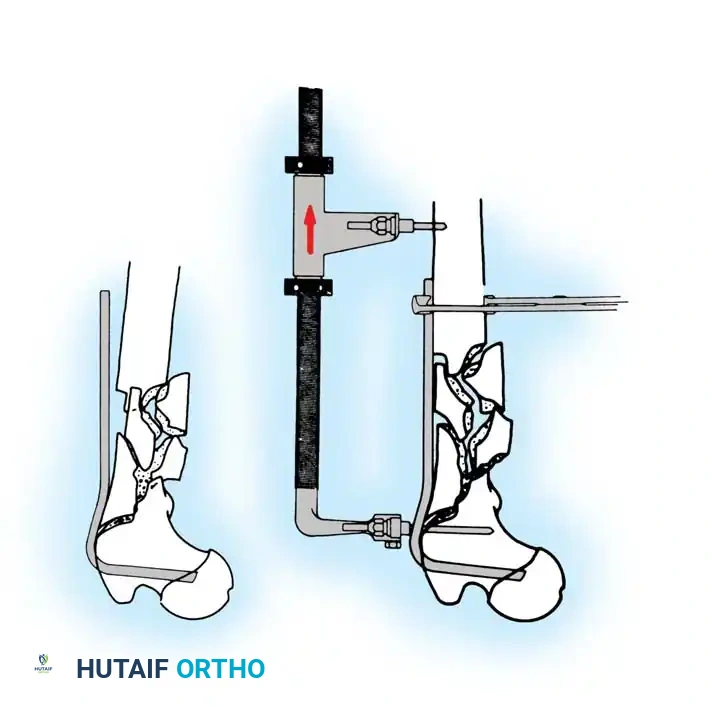 Hutaifortho's Orthopaedic Diagram