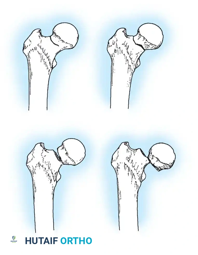Hutaifortho's Orthopaedic Diagram