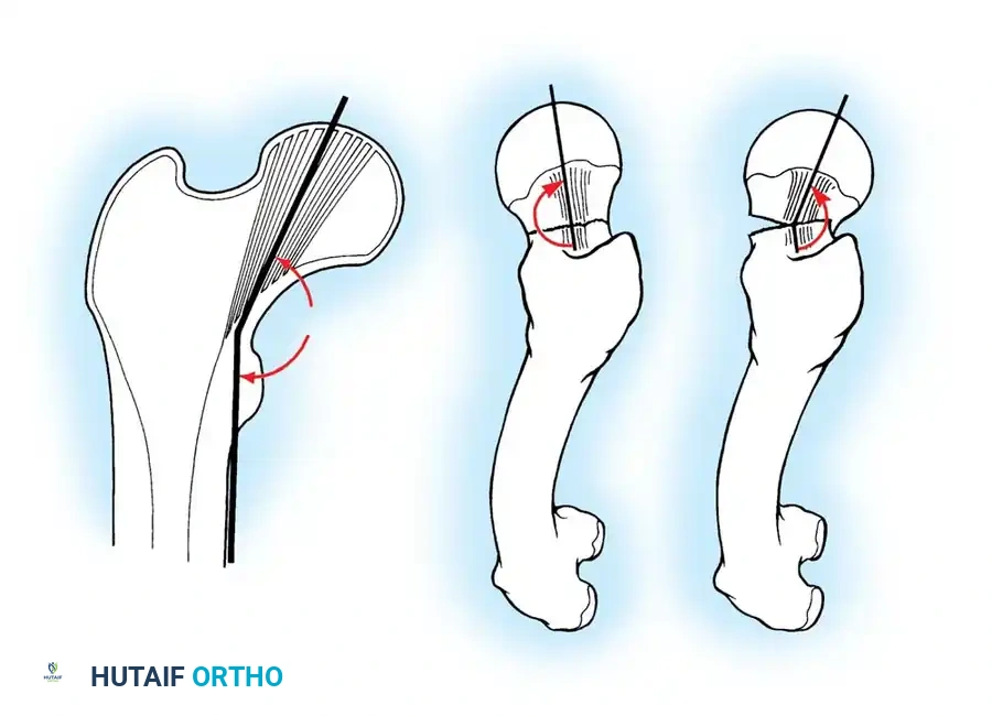 Hutaifortho's Orthopaedic Diagram