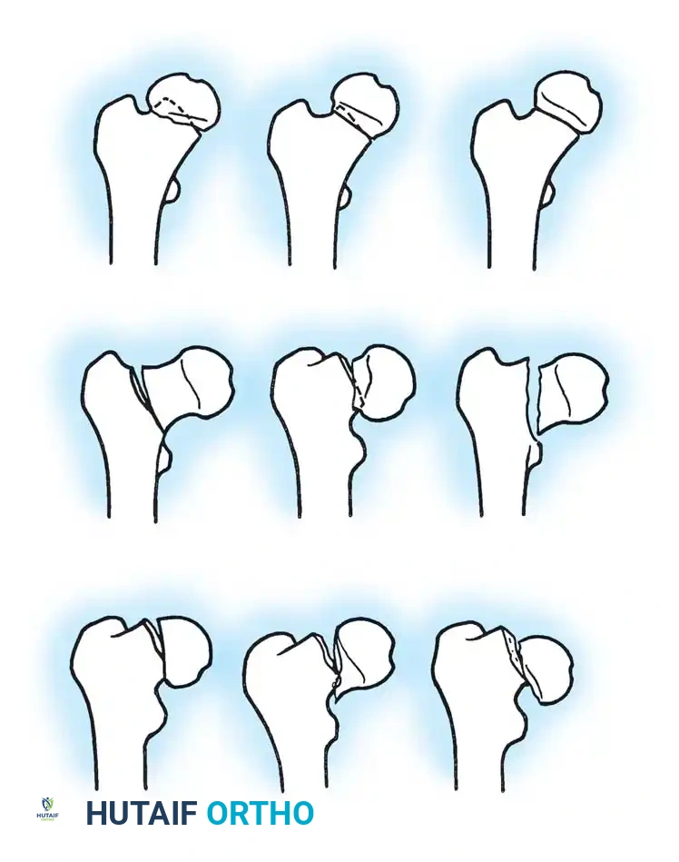 Hutaifortho's Orthopaedic Diagram