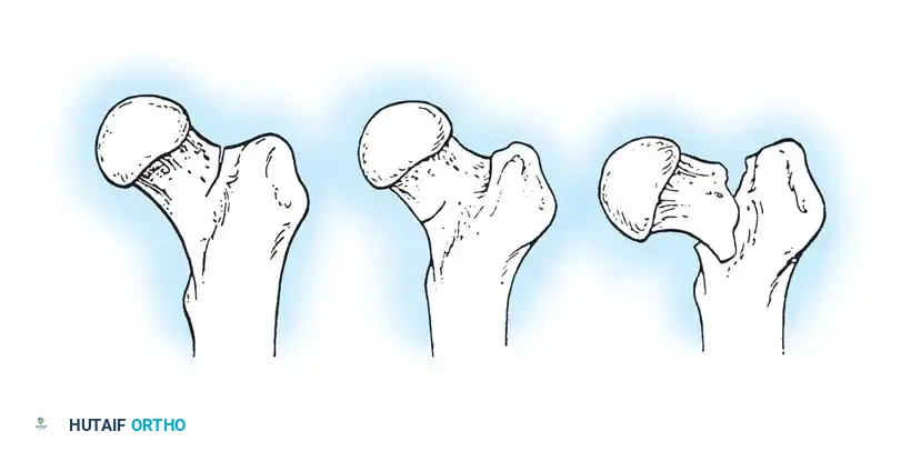 Hutaifortho's Orthopaedic Diagram