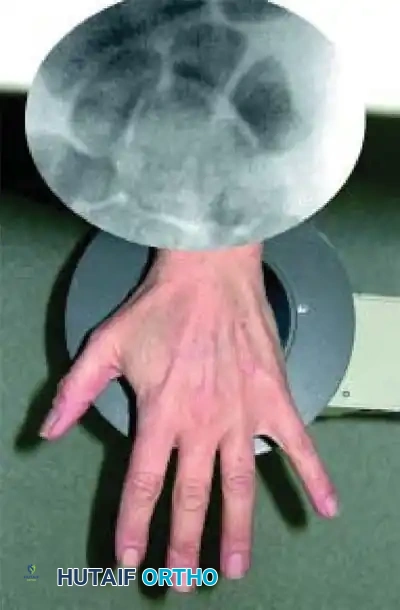 Hutaifortho's Orthopaedic Diagram