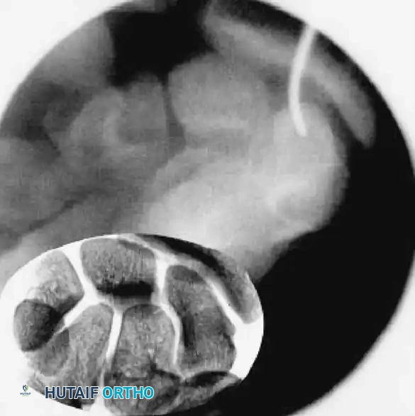 Hutaifortho's Orthopaedic Diagram