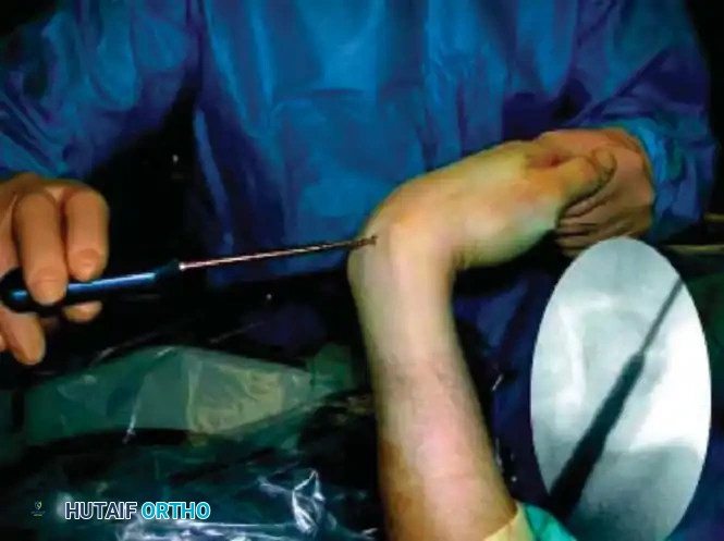 Hutaifortho's Orthopaedic Diagram