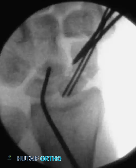 Hutaifortho's Orthopaedic Diagram