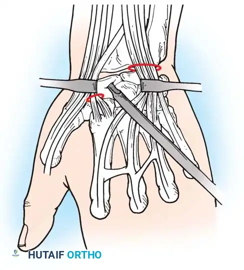 Hutaifortho's Orthopaedic Diagram
