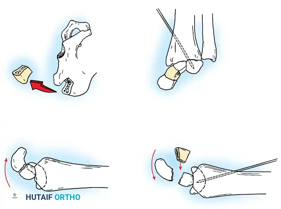 Hutaifortho's Orthopaedic Diagram