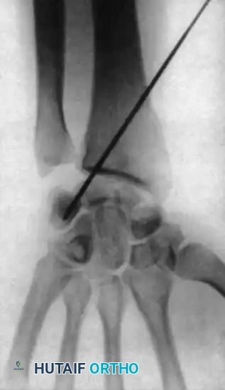 Hutaifortho's Orthopaedic Diagram