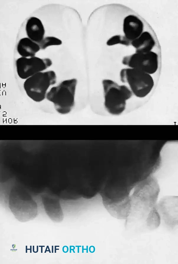 Hutaifortho's Orthopaedic Diagram