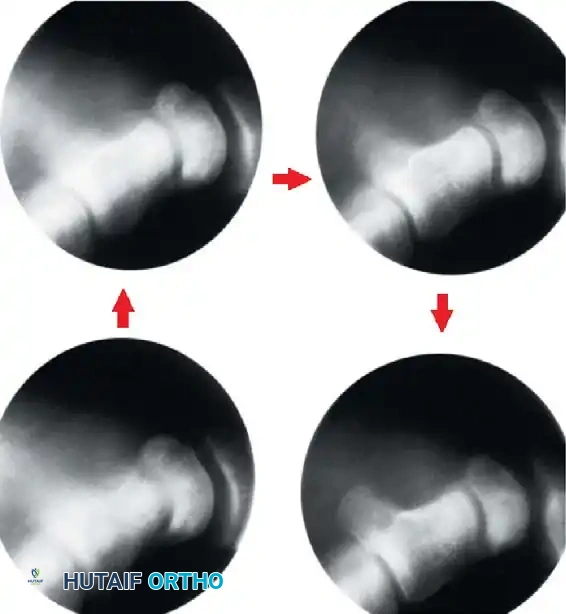 Hutaifortho's Orthopaedic Diagram