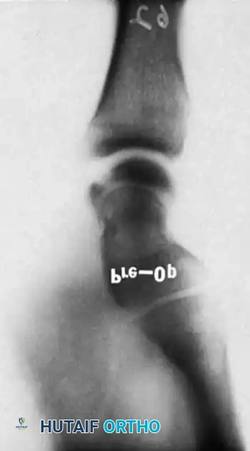 Hutaifortho's Orthopaedic Diagram