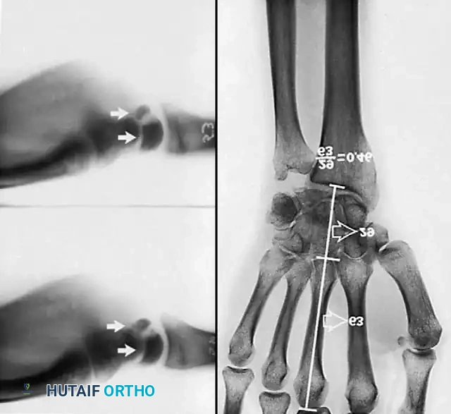 Hutaifortho's Orthopaedic Diagram