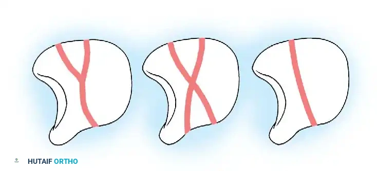 Hutaifortho's Orthopaedic Diagram