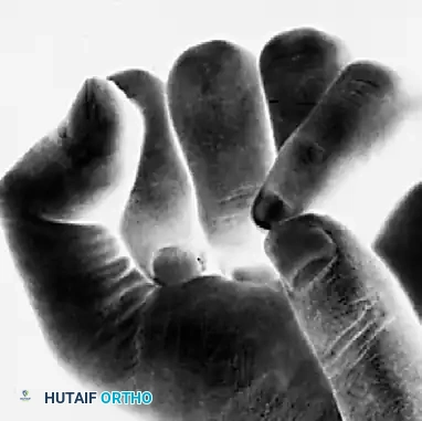 FRACTURES, DISLOCATIONS, AND LIGAMENTOUS INJURIES James H. Calandruccio Surgical Diagram