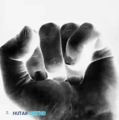 FRACTURES, DISLOCATIONS, AND LIGAMENTOUS INJURIES James H. Calandruccio Surgical Diagram