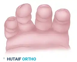FRACTURES, DISLOCATIONS, AND LIGAMENTOUS INJURIES James H. Calandruccio Surgical Diagram