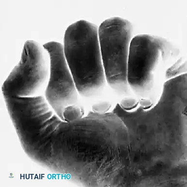 FRACTURES, DISLOCATIONS, AND LIGAMENTOUS INJURIES James H. Calandruccio Surgical Diagram