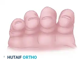 FRACTURES, DISLOCATIONS, AND LIGAMENTOUS INJURIES James H. Calandruccio Surgical Diagram
