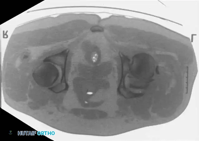 Hutaifortho's Orthopaedic Diagram