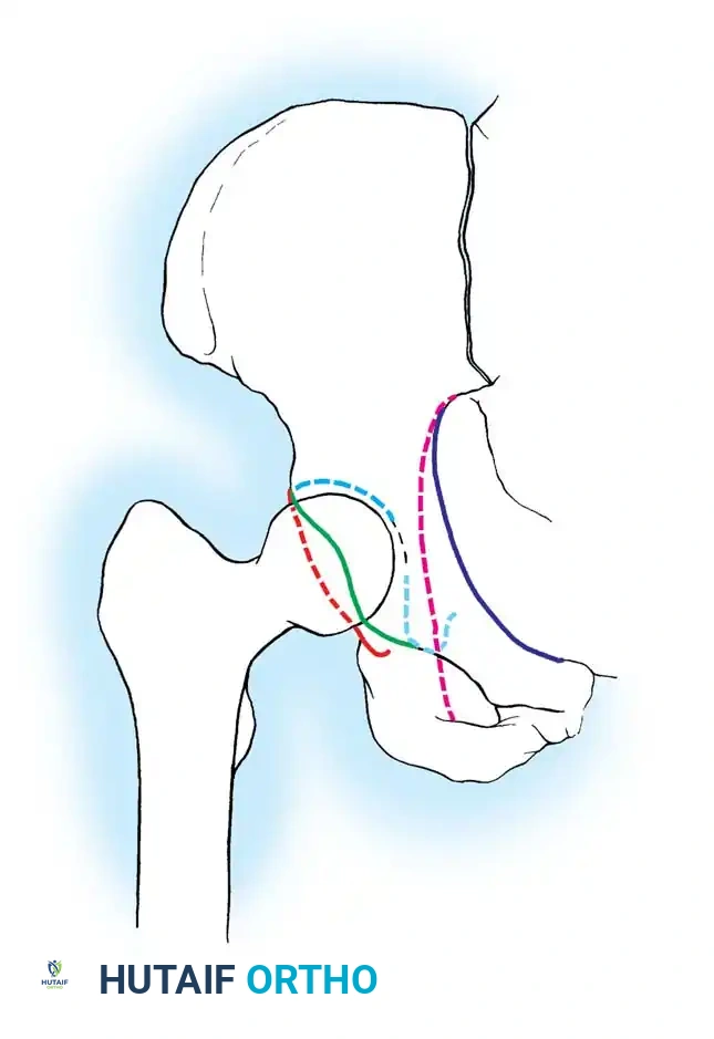 Hutaifortho's Orthopaedic Diagram