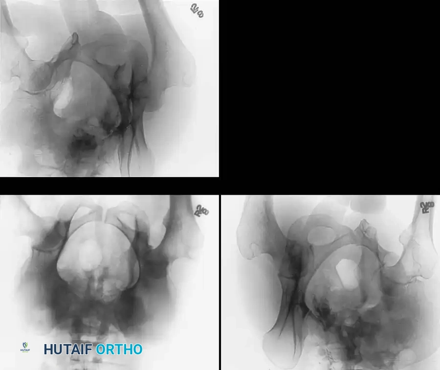 Hutaifortho's Orthopaedic Diagram
