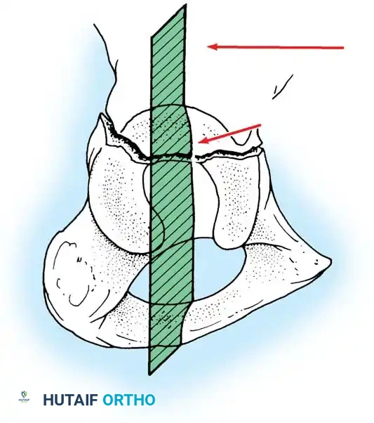 Hutaifortho's Orthopaedic Diagram