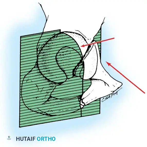 Hutaifortho's Orthopaedic Diagram