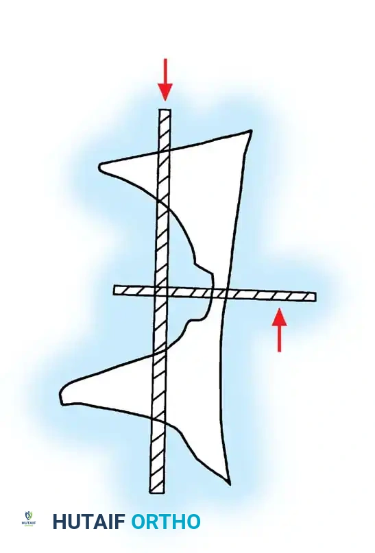 Hutaifortho's Orthopaedic Diagram