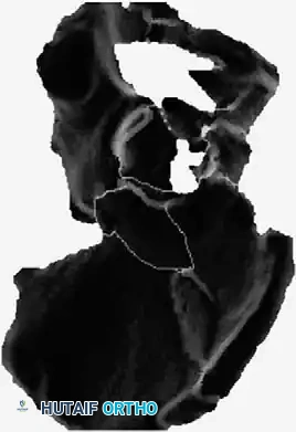 Hutaifortho's Orthopaedic Diagram