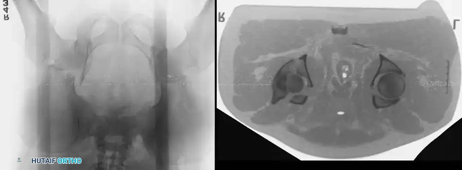 Hutaifortho's Orthopaedic Diagram