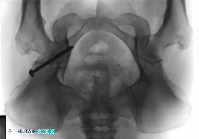 Hutaifortho's Orthopaedic Diagram